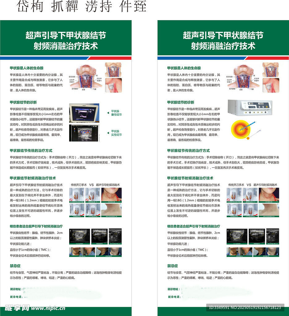 张洪铭展架