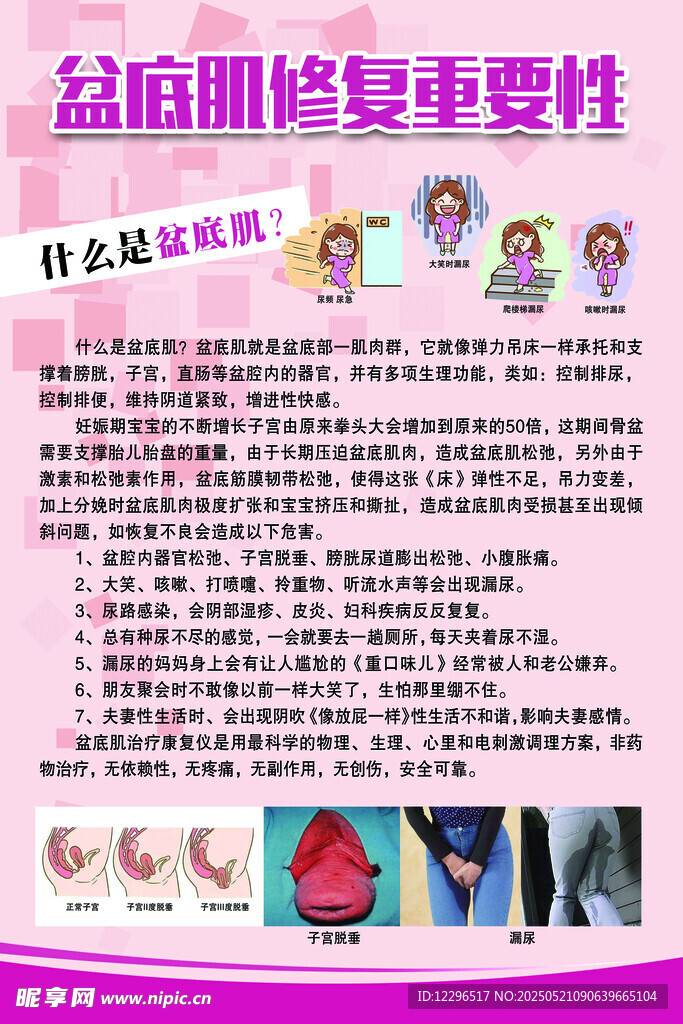 盆底肌修复重要性介绍