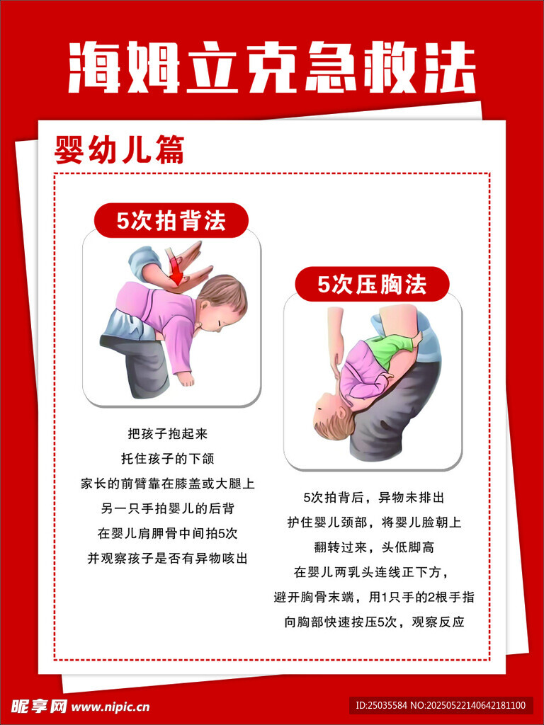 婴幼儿海姆立克急救法图示