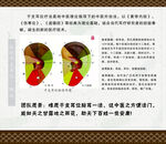 耳位标准耳图