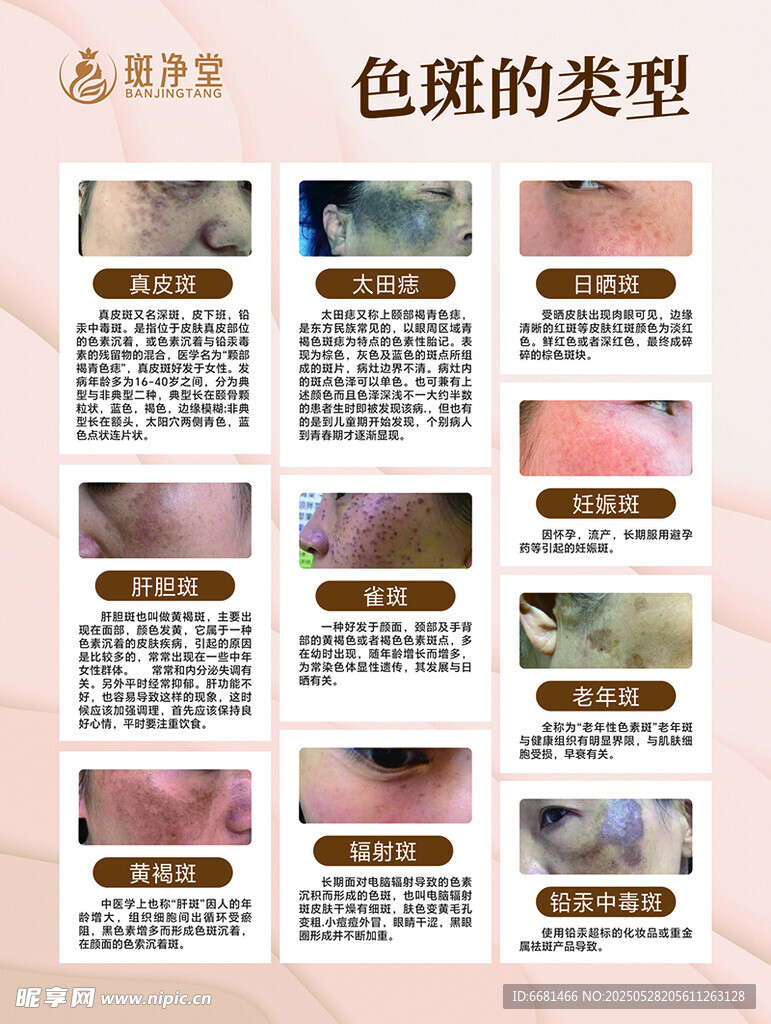 美容海报色斑的分类