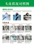 头皮状况对比展示图