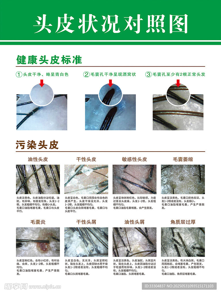 头皮状况对比展示图