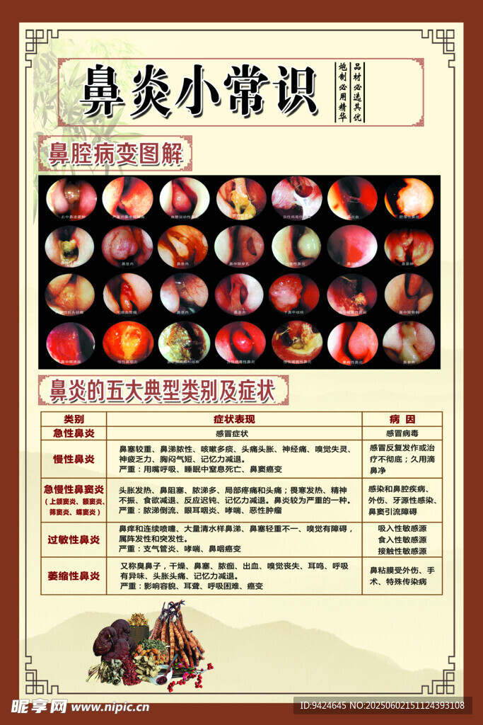 鼻炎常识海报展示