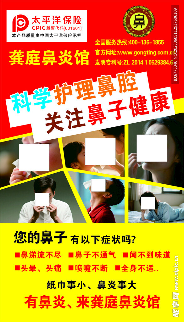 鼻炎  