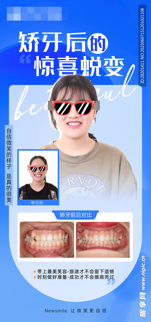  口腔案例海报