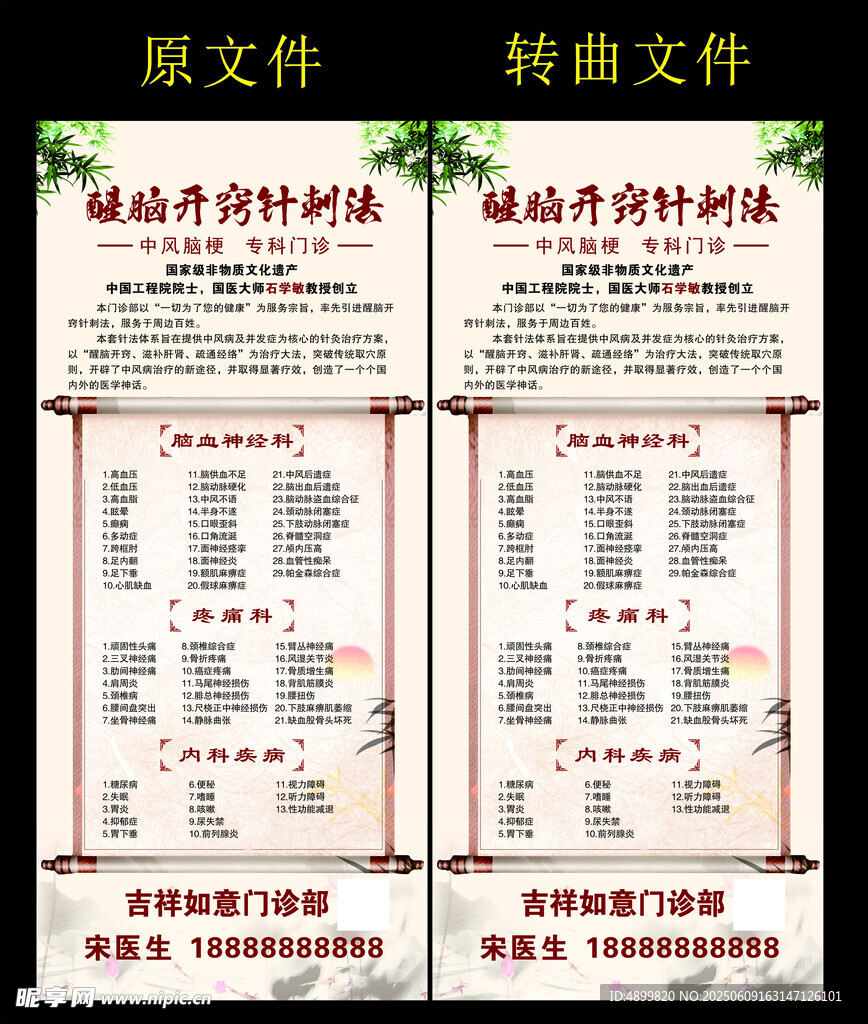 醒脑开窍针刺法