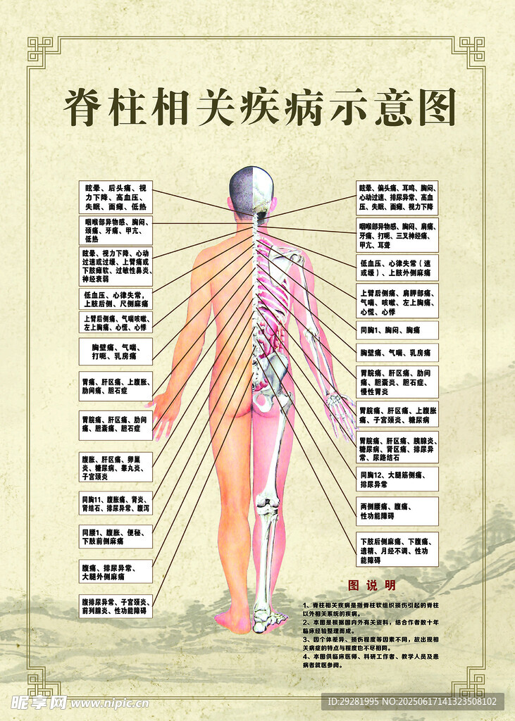 脊柱相关疾病示意图
