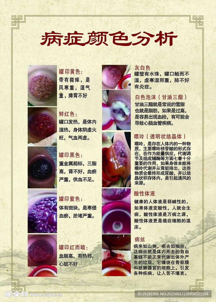 病症颜色分析展示