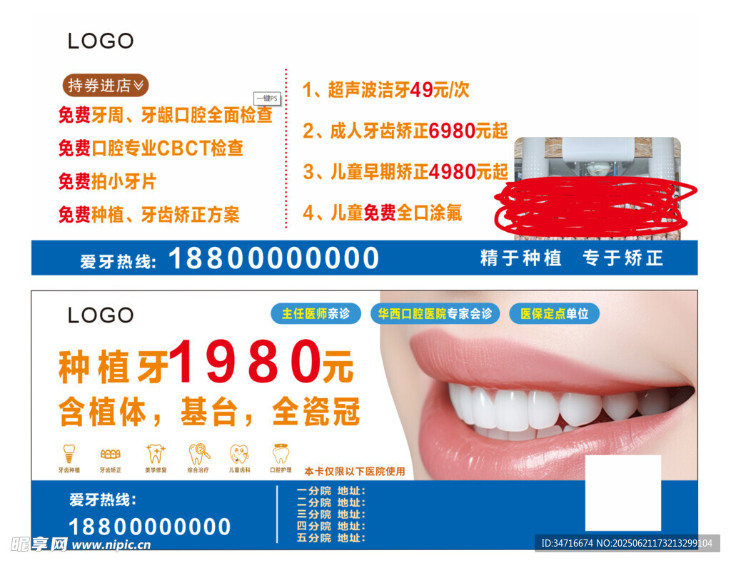 牙齿种植优惠广告