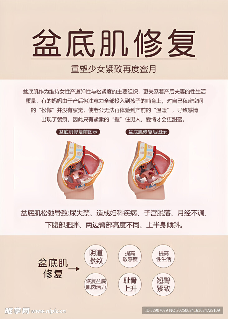 盆底肌修复知识科普