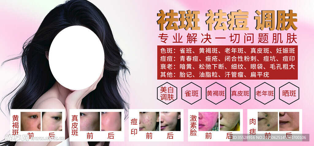 美容