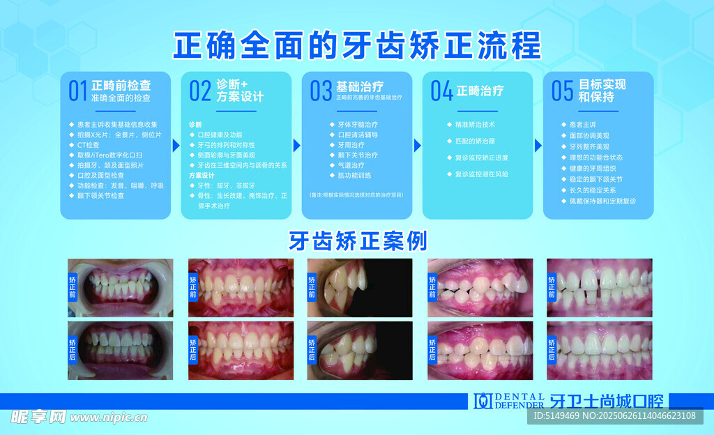 正畸牙套活动流程展示