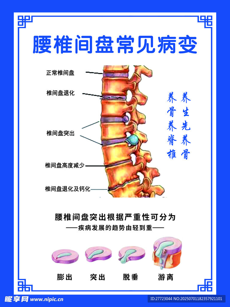 腰椎间盘常见病变图示