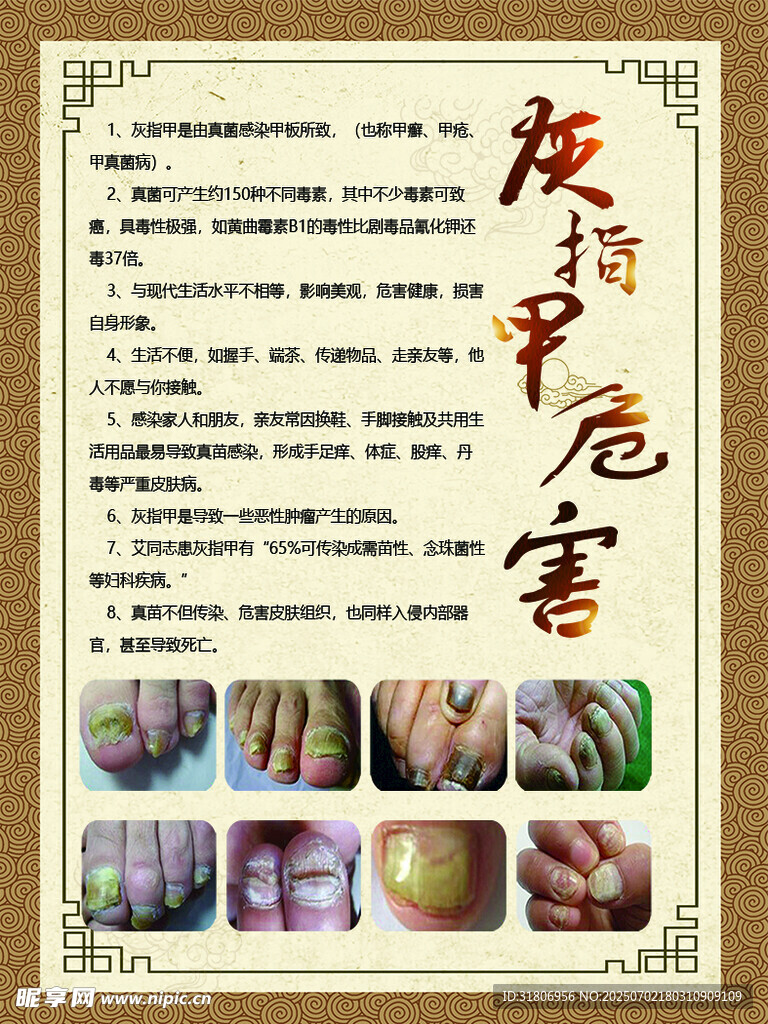 灰指甲危害介绍