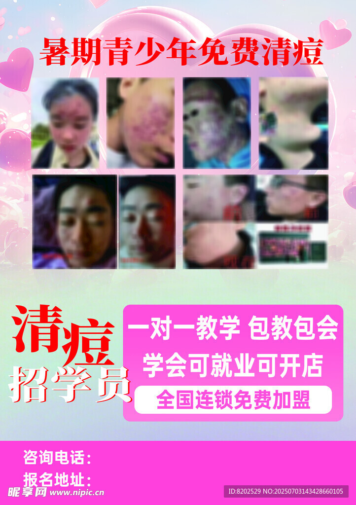 暑期青少年 清痘