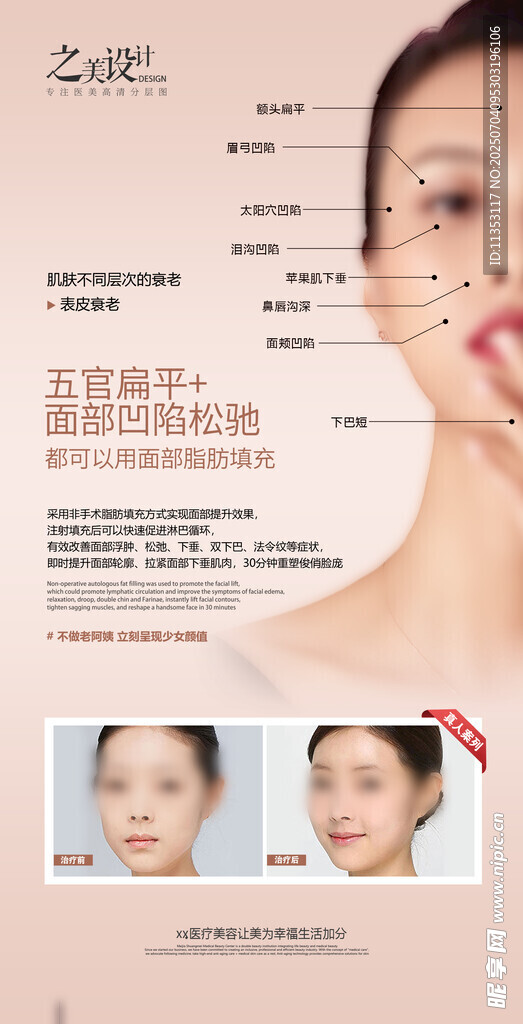 医美海报脂肪填充
