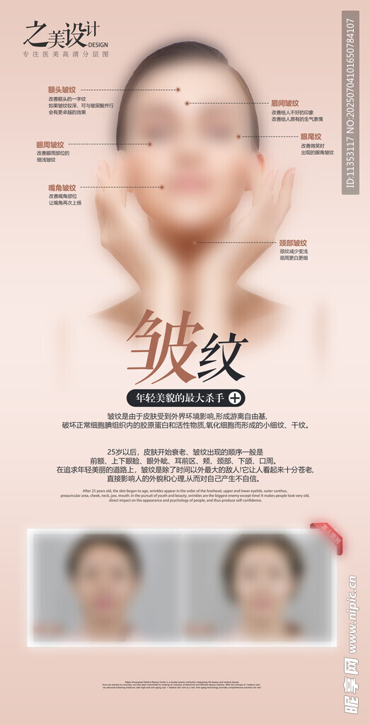 皱纹 