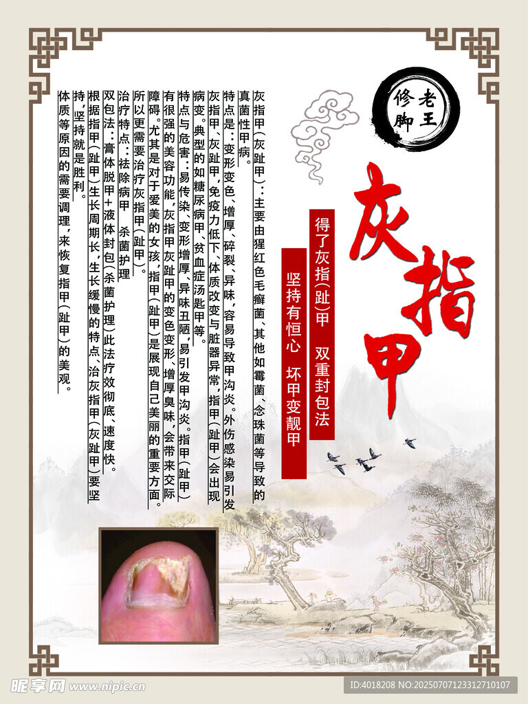 灰指甲