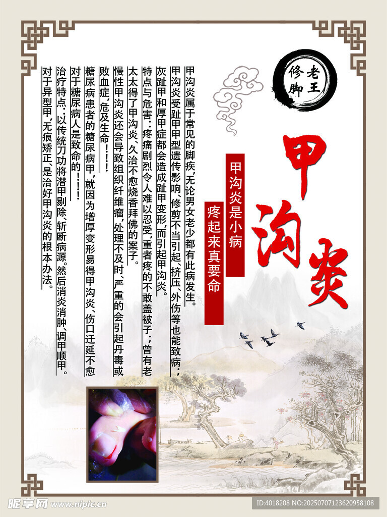 甲沟炎海报