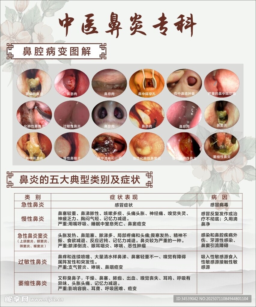 中医鼻炎专科宣传页展示