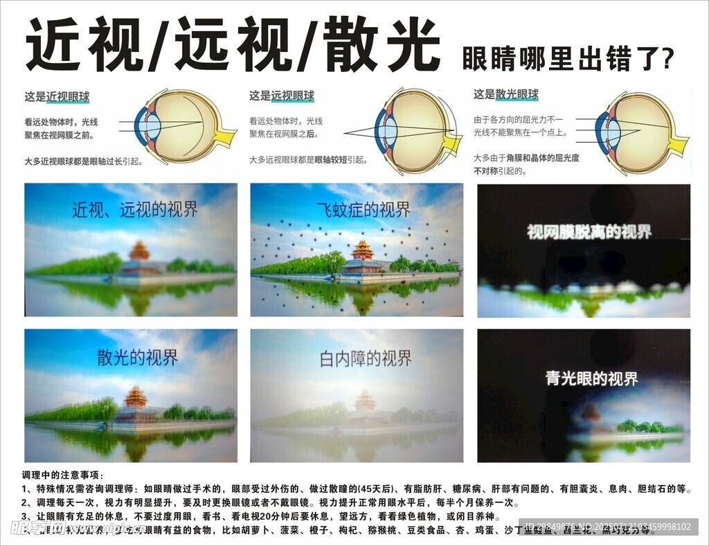 视力矫正宣传素材展示