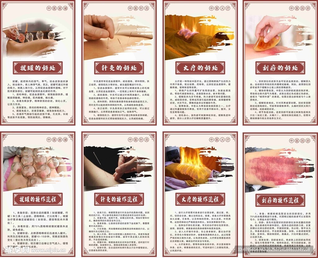 中医拔罐针灸刮痧火疗