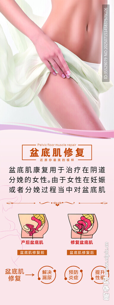 盆底肌修复