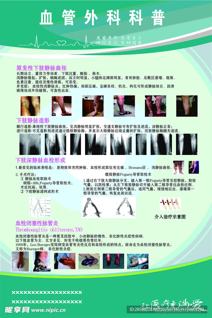 血管外科医疗信息展示