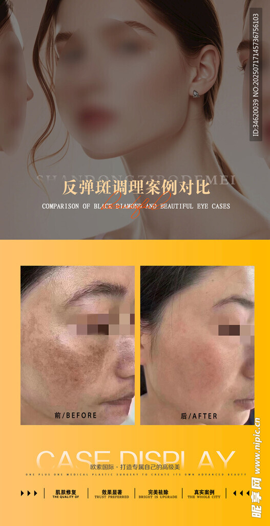 美业案例对比图