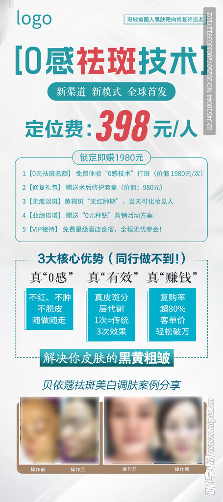 祛斑展架海报
