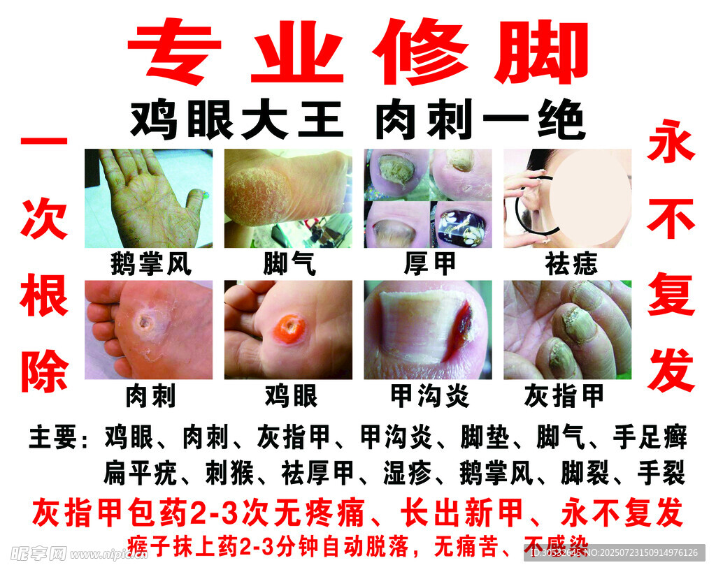 专业修脚