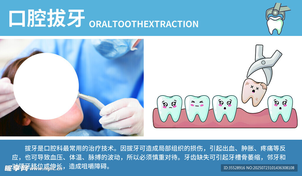 口腔拔牙科普图示