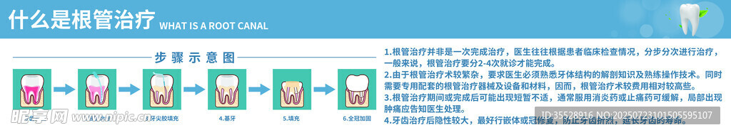 牙齿根管治疗