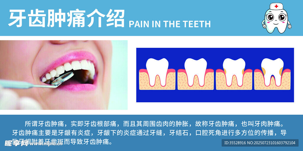 牙齿肿痛介绍图示