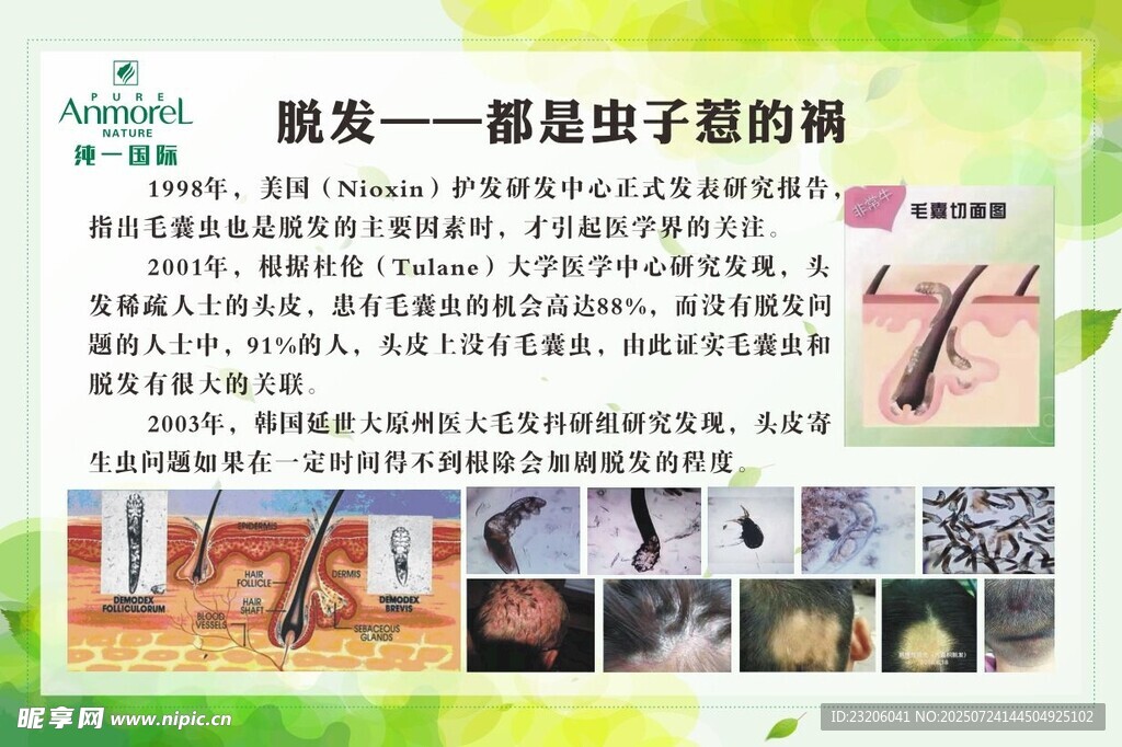 脱发