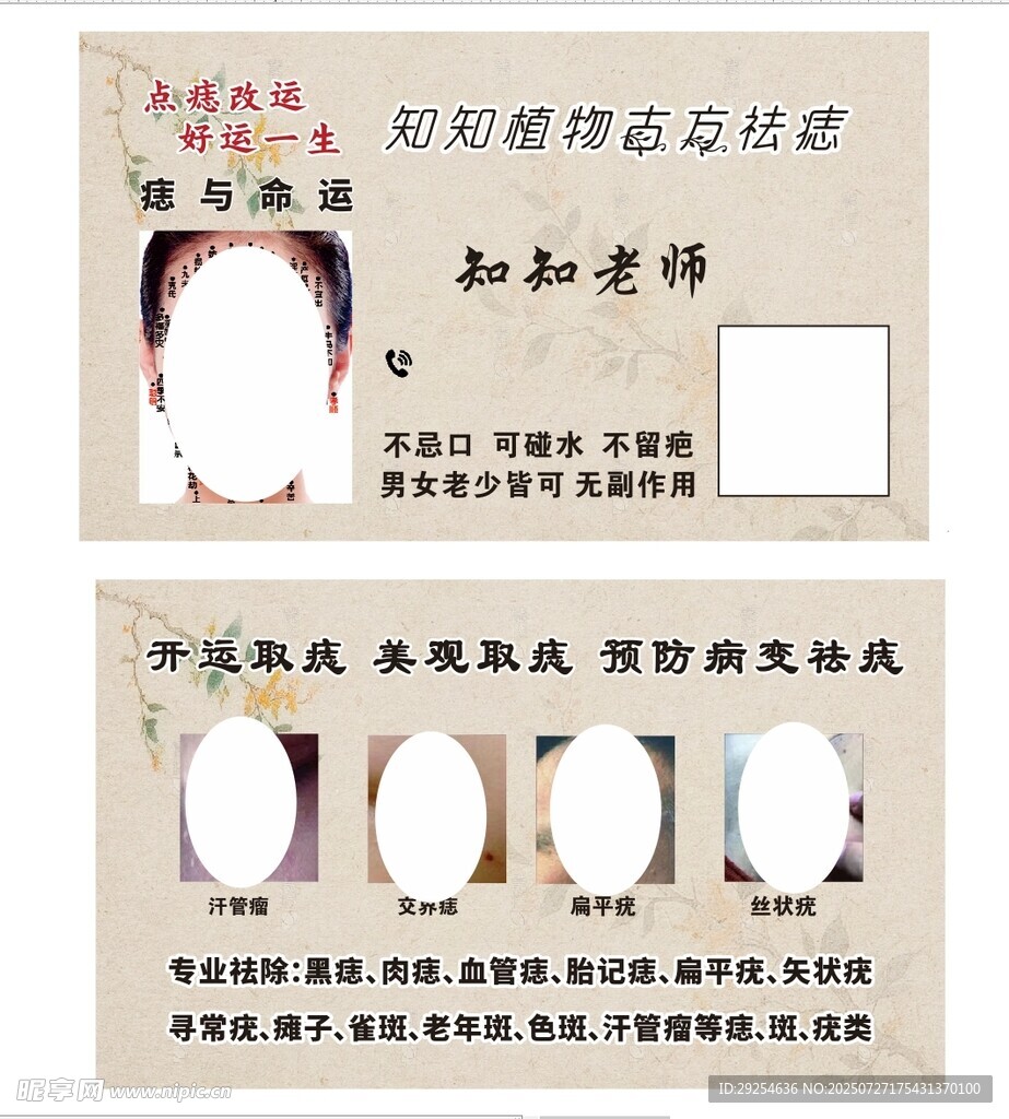 去痣