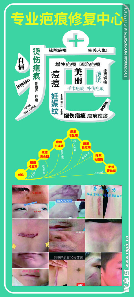 专业祛痘服务