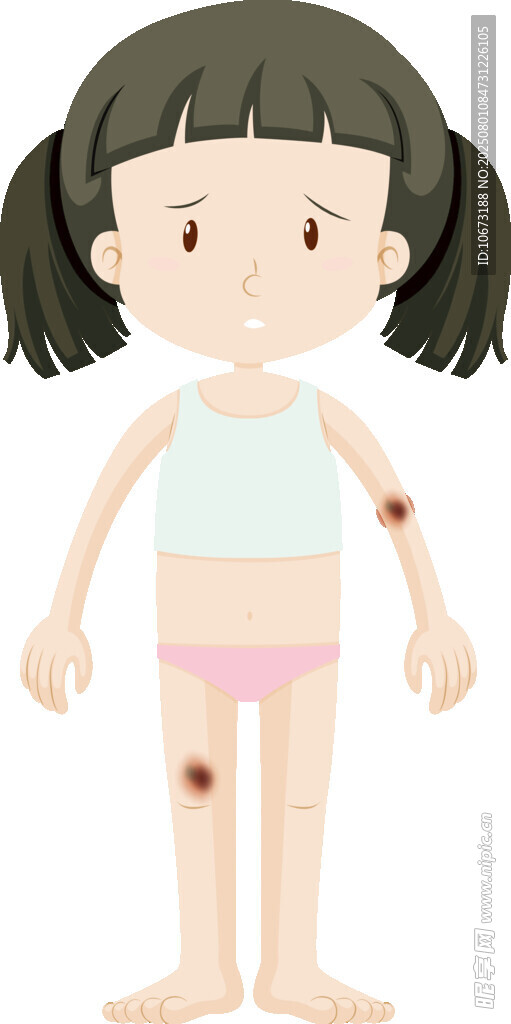 身上有瘀斑的小女孩
