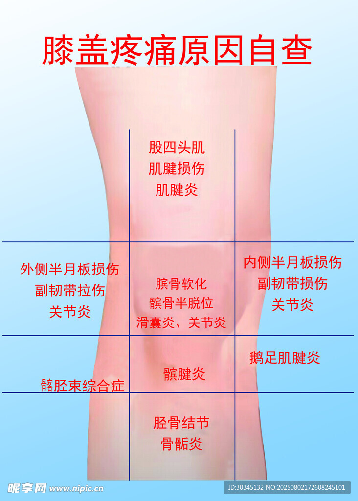 膝盖疼痛原因自查图