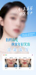 医美口周年轻化海报