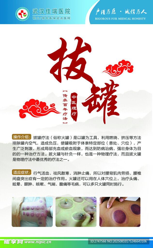 拔罐