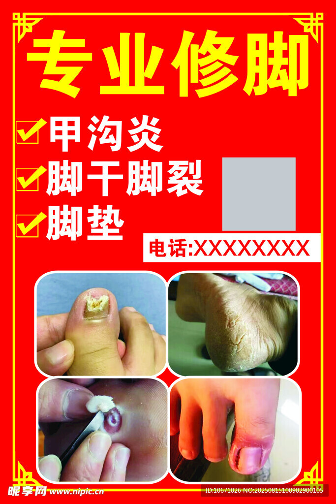 专业修脚服务展示