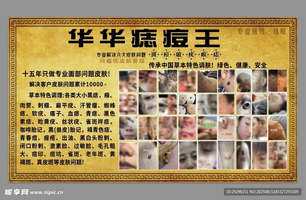 治痘宣传海报