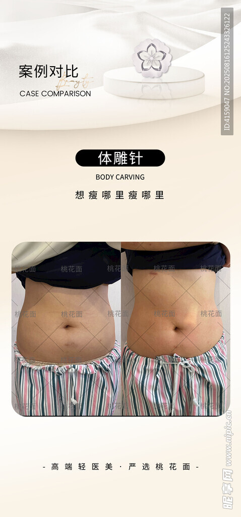 腹部减肥前后对比图
