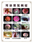 耳朵常见病症