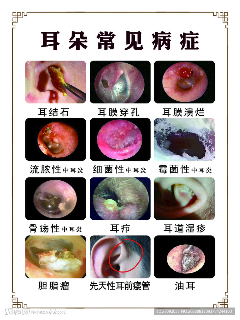 耳朵常见病症