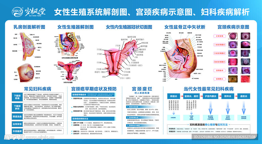 女性生殖系统解剖示意图