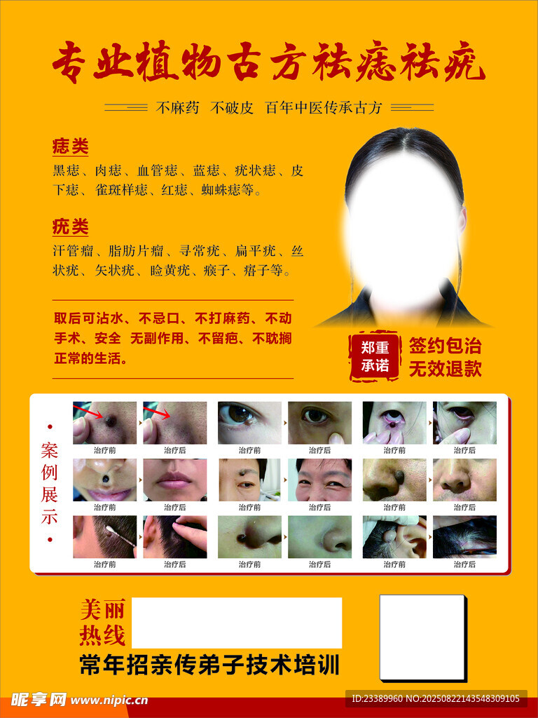 专业植物古方袪痣袪疣 海报