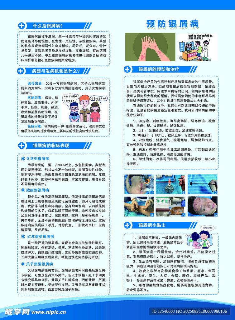 银屑病宣传单